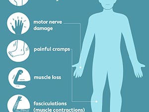 NEUROPATHY / MUSCLE INFLAMMATION